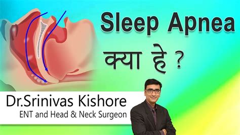 sleep apnea meaning in hindi